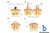 Nội nha
